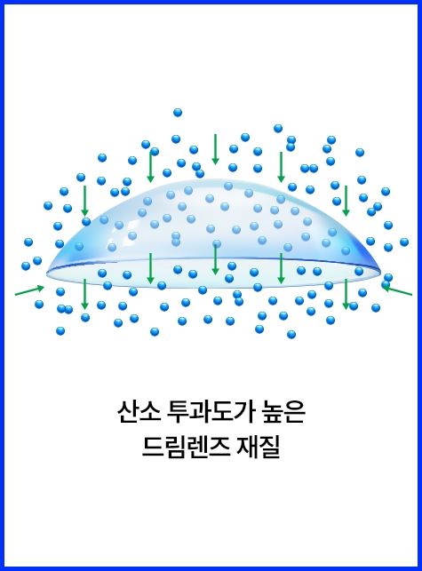 산소 투과도가 높은 드림렌즈 재질